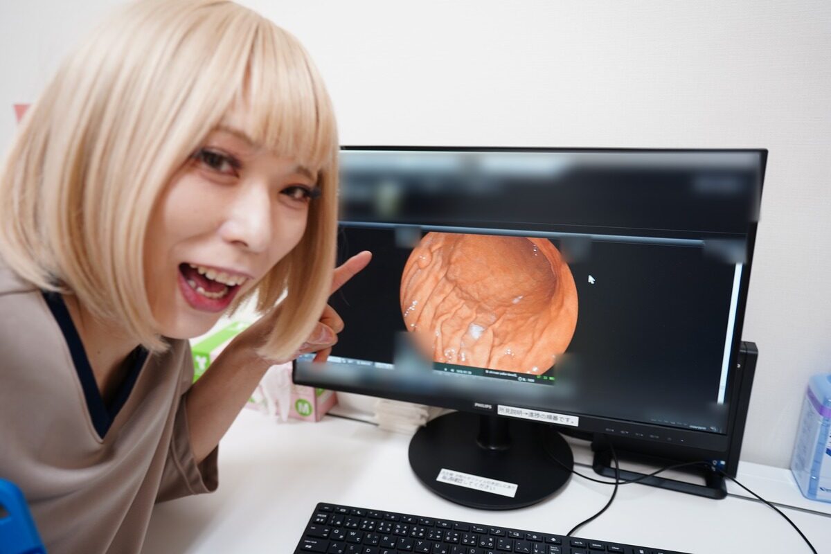 胃カメラ画像としゃちょ美